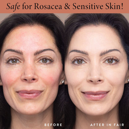 Double Take Liquid Foundation Model B&A in Fair Safe for Rosacea